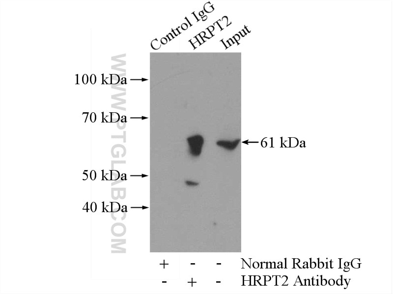 IP experiment of mouse testis using 12310-1-AP