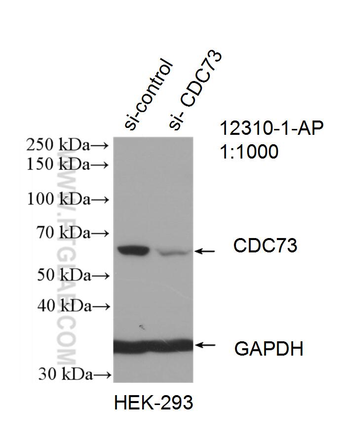 Western Blot (WB) analysis of HEK-293 cells using HRPT2, CDC73 Polyclonal antibody (12310-1-AP)