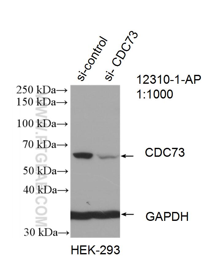 WB analysis of HEK-293 using 12310-1-AP