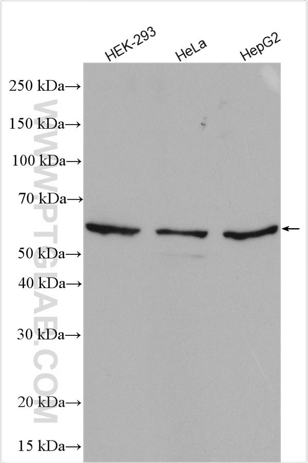 Western Blot (WB) analysis of various lysates using HRPT2, CDC73 Polyclonal antibody (12310-1-AP)