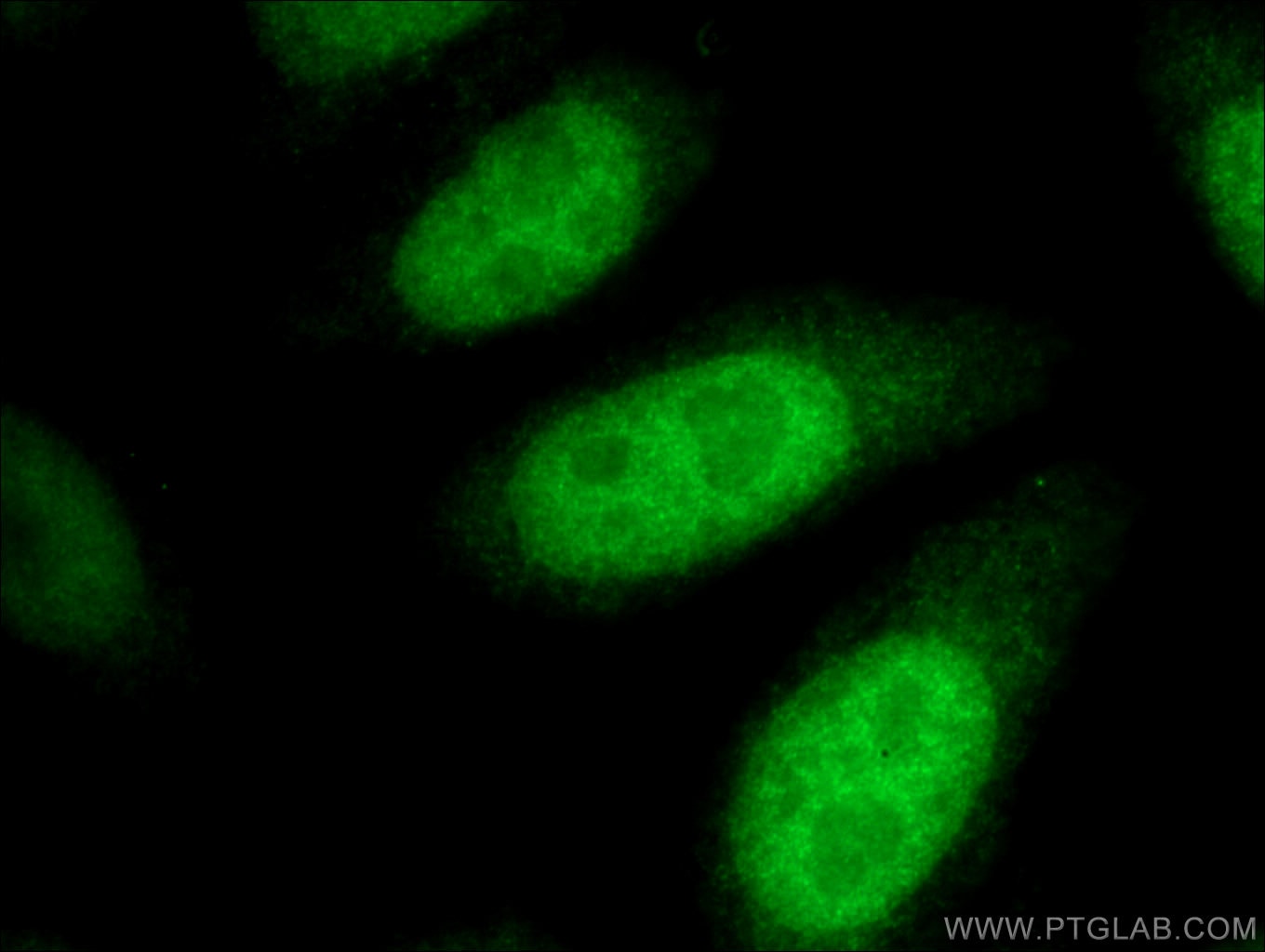 Immunofluorescence (IF) / fluorescent staining of HepG2 cells using CDCA2 Polyclonal antibody (17701-1-AP)