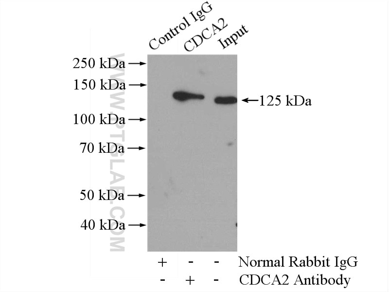 Immunoprecipitation (IP) experiment of Jurkat cells using CDCA2 Polyclonal antibody (17701-1-AP)