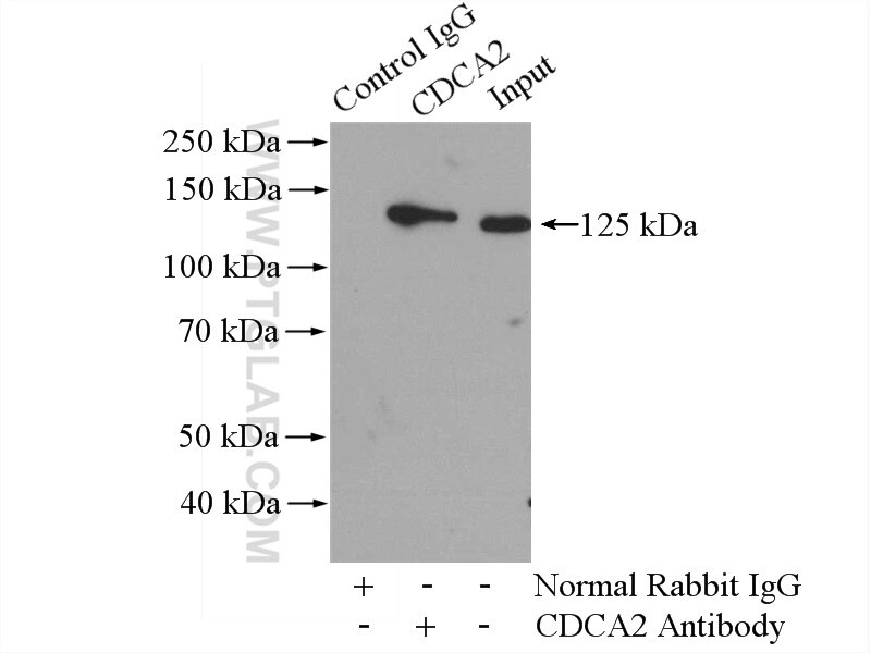 Immunoprecipitation (IP) experiment of Jurkat cells using CDCA2 Polyclonal antibody (17701-1-AP)