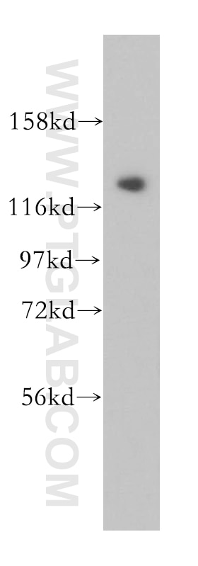 Western Blot (WB) analysis of Jurkat cells using CDCA2 Polyclonal antibody (17701-1-AP)
