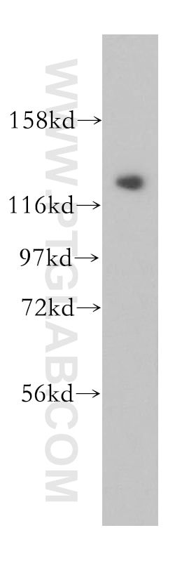 WB analysis of Jurkat using 17701-1-AP