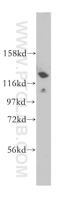 Western Blot (WB) analysis of HepG2 cells using CDCA2 Polyclonal antibody (17701-1-AP)