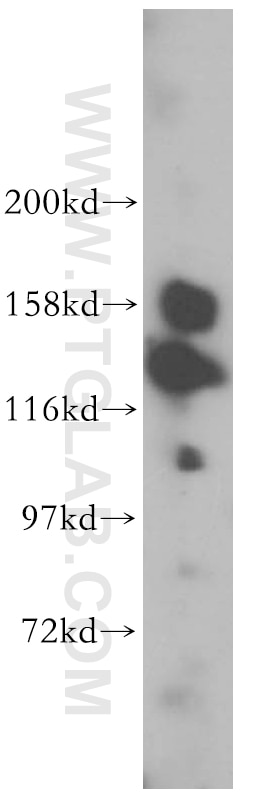 Western Blot (WB) analysis of MCF-7 cells using CDCA2 Polyclonal antibody (17701-1-AP)