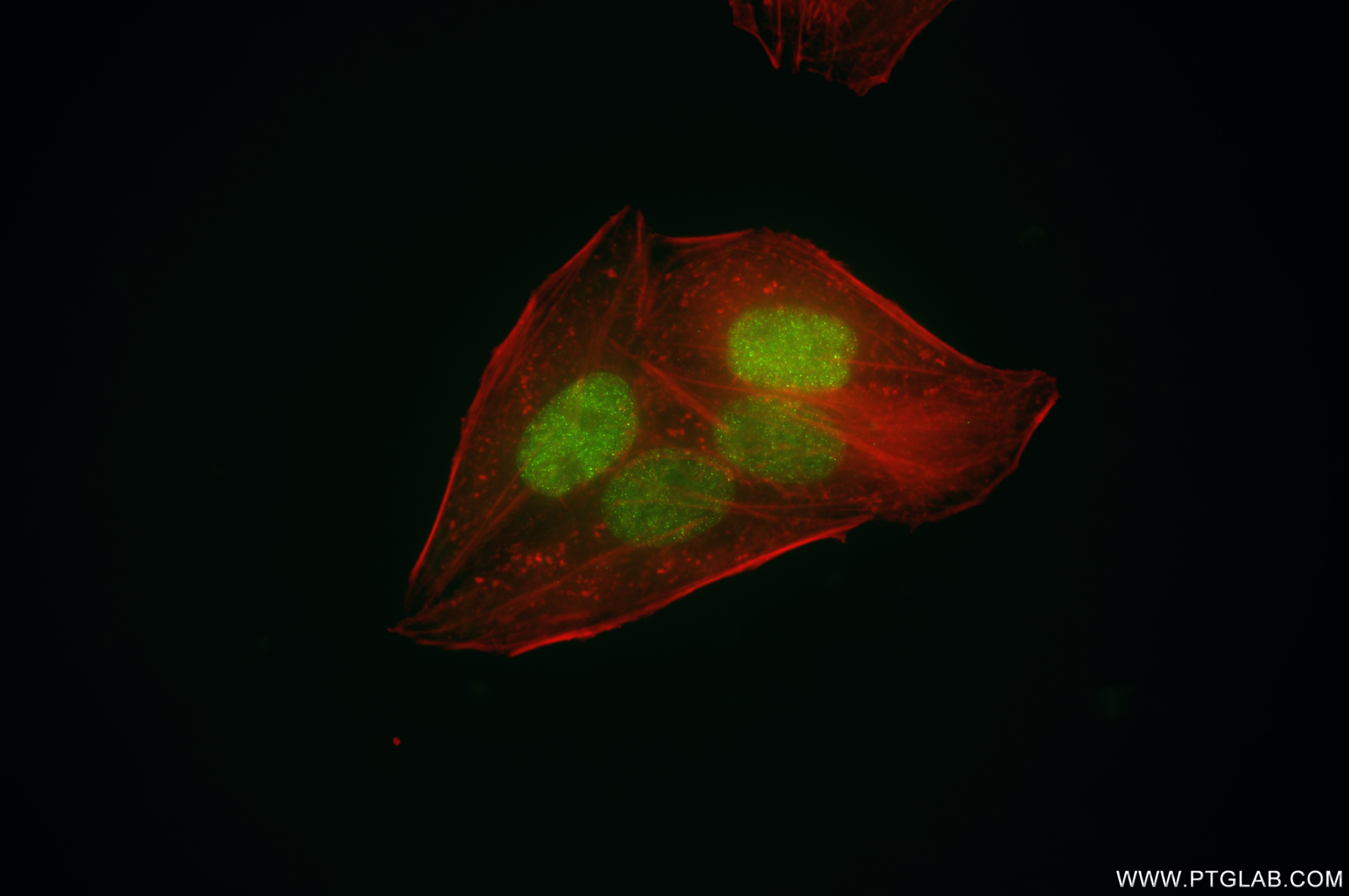 Immunofluorescence (IF) / fluorescent staining of HepG2 cells using CDCA2 Recombinant antibody (86379-1-RR)