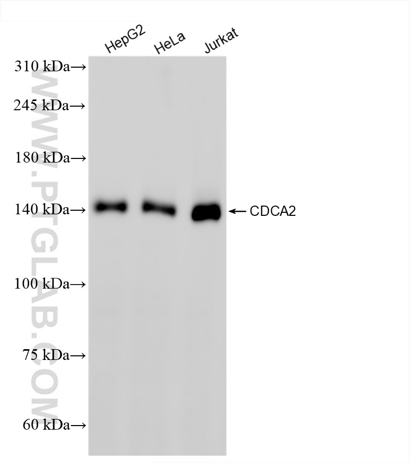 Western Blot (WB) analysis of various lysates using CDCA2 Recombinant antibody (86379-1-RR)
