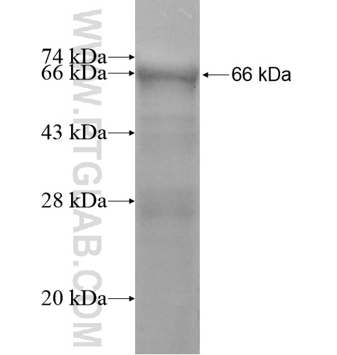 CDCA2 fusion protein Ag11967 SDS-PAGE