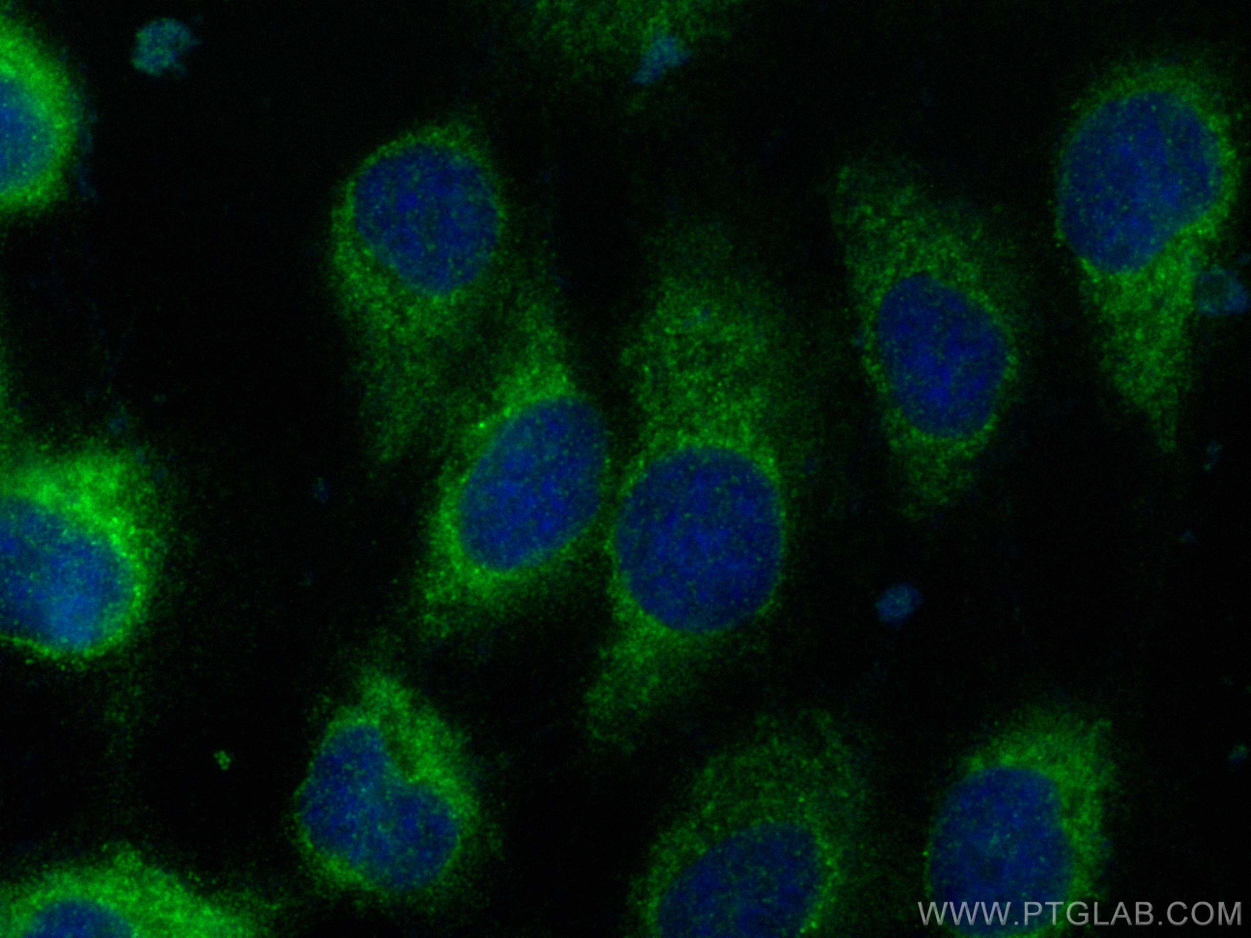 Immunofluorescence (IF) / fluorescent staining of A431 cells using CDCA3 Polyclonal antibody (15594-1-AP)