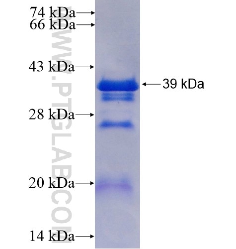 CDCA3 fusion protein Ag7951 SDS-PAGE