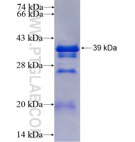 CDCA3 fusion protein Ag7951 SDS-PAGE