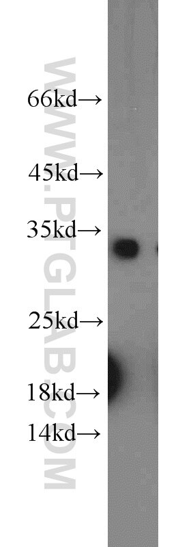 Western Blot (WB) analysis of HeLa cells using CDCA4 Polyclonal antibody (11625-1-AP)