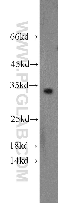Western Blot (WB) analysis of HeLa cells using CDCA4 Polyclonal antibody (11625-1-AP)