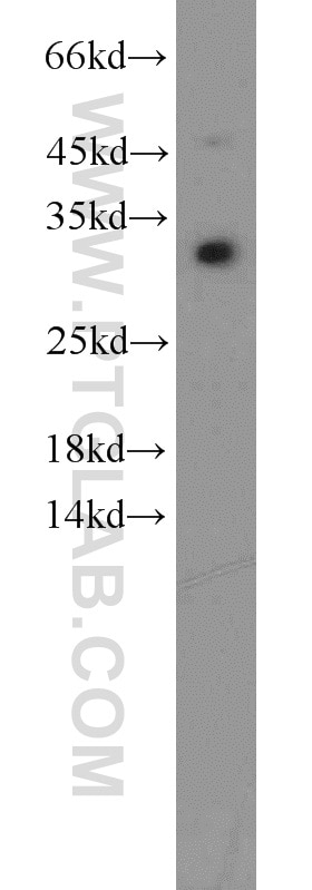 Western Blot (WB) analysis of HEK-293 cells using CDCA4 Polyclonal antibody (11625-1-AP)