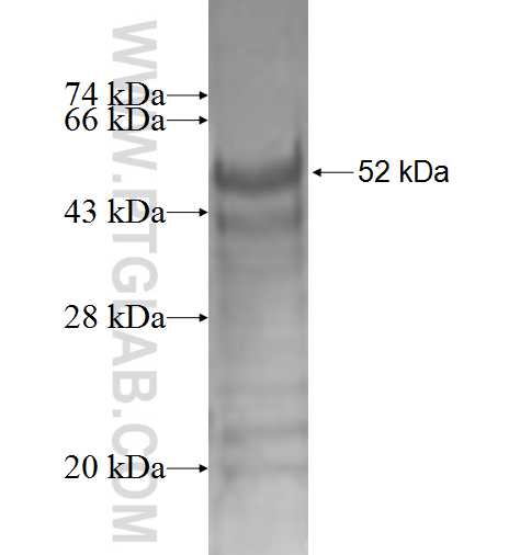 CDCA4 fusion protein Ag2214 SDS-PAGE
