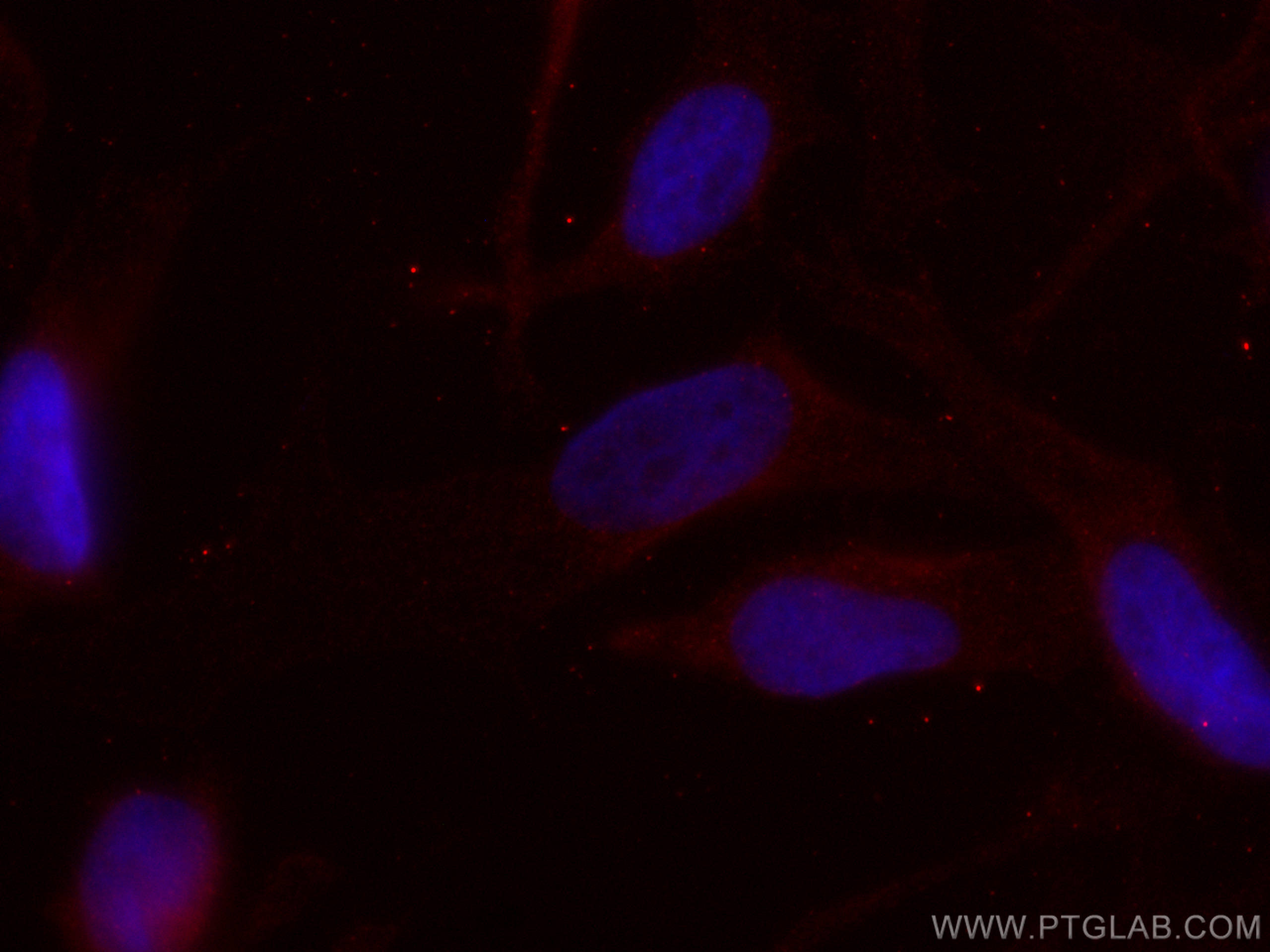Immunofluorescence (IF) / fluorescent staining of HeLa cells using CoraLite®594-conjugated CDCA5 Monoclonal antibody (CL594-67418)