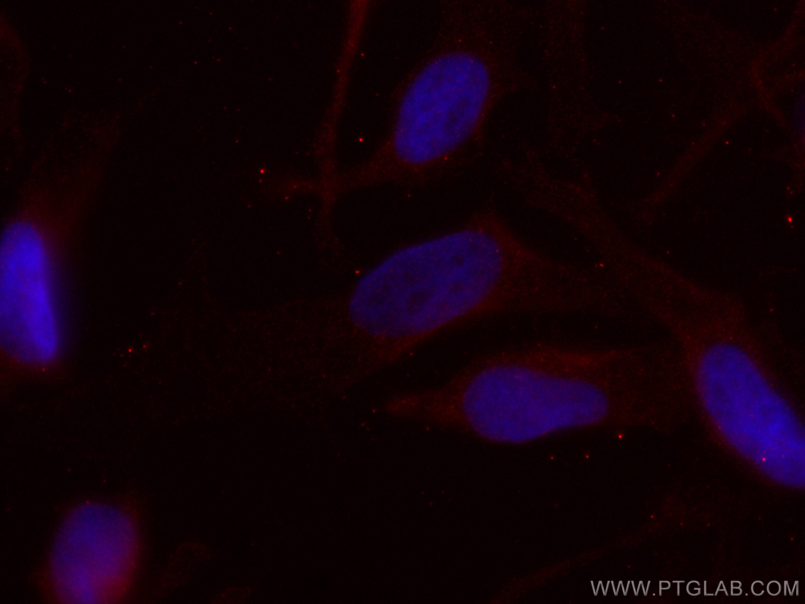 IF Staining of HeLa using CL594-67418