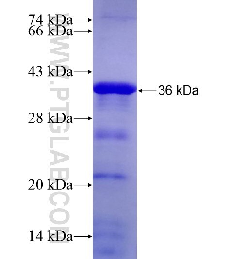 CDCA5 fusion protein Ag28958 SDS-PAGE