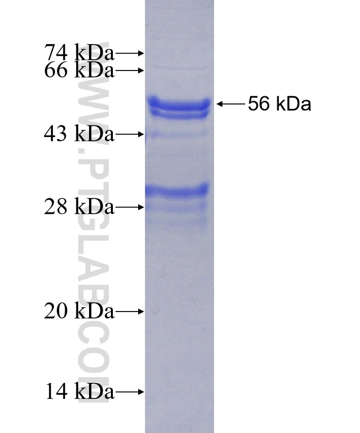 CDCA5 fusion protein Ag1414 SDS-PAGE