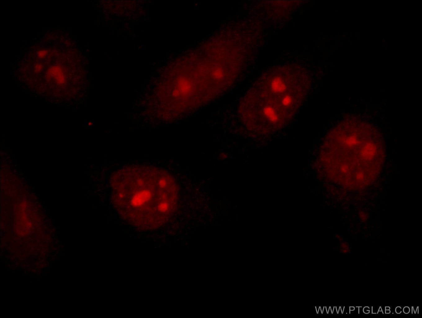 Immunofluorescence (IF) / fluorescent staining of HepG2 cells using CDCA7 Polyclonal antibody (15249-1-AP)