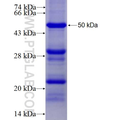 CDCA7 fusion protein Ag4297 SDS-PAGE