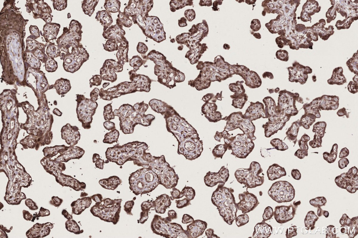Immunohistochemistry (IHC) staining of human placenta tissue using CDCA7L Recombinant monoclonal antibody (83682-4-RR)
