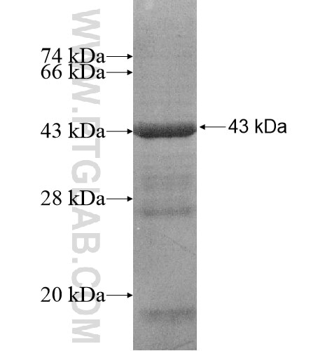 CDCA7L fusion protein Ag10944 SDS-PAGE