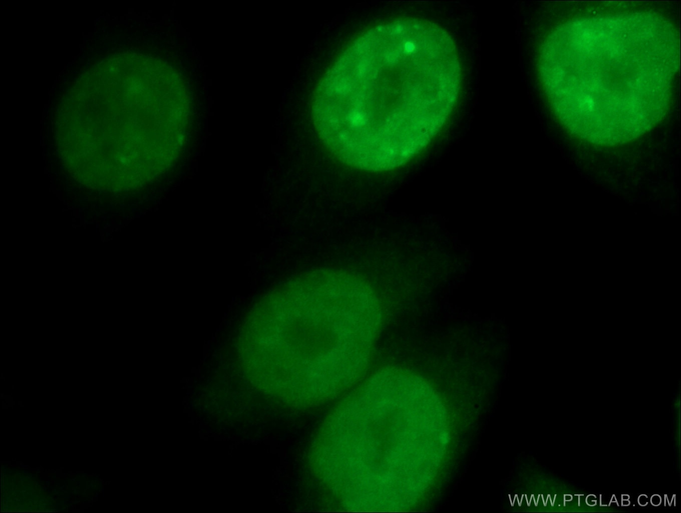 Immunofluorescence (IF) / fluorescent staining of HeLa cells using CDCA8 Polyclonal antibody (12465-1-AP)