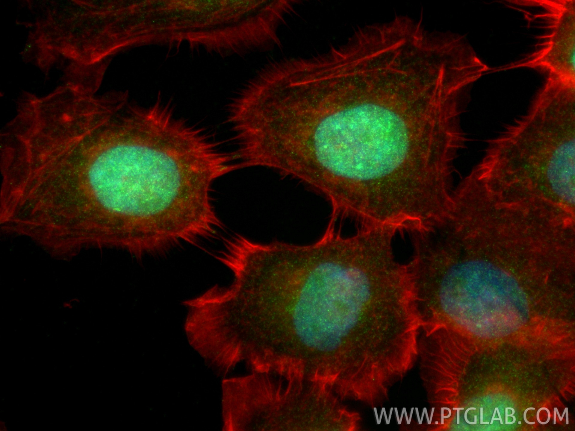 Immunofluorescence (IF) / fluorescent staining of A431 cells using CDCA8 Polyclonal antibody (12465-1-AP)