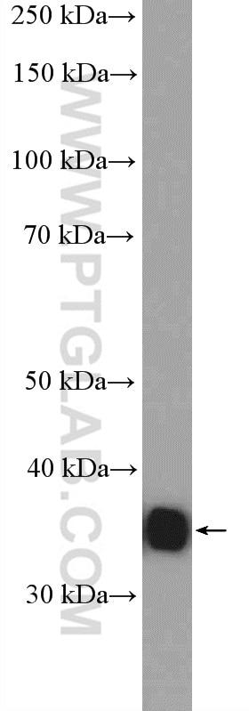 Western Blot (WB) analysis of mouse kidney tissue using CDCA8 Polyclonal antibody (12465-1-AP)