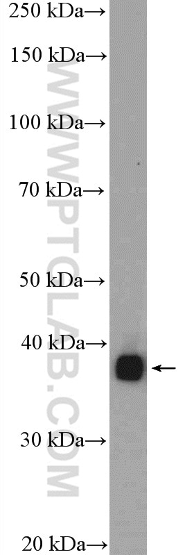 Western Blot (WB) analysis of A549 cells using CDCA8 Polyclonal antibody (12465-1-AP)