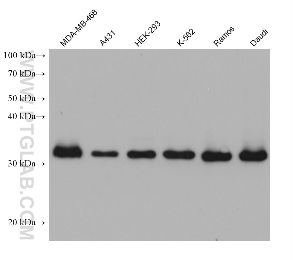 Western Blot (WB) analysis of various lysates using CDCA8 Monoclonal antibody (68510-1-Ig)