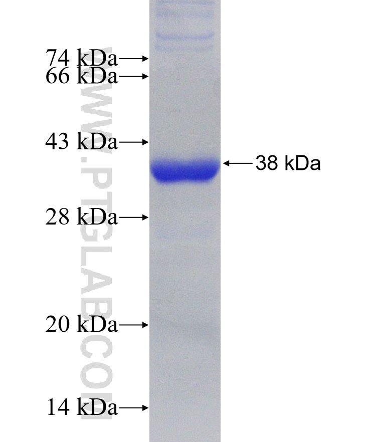 CDCA8 fusion protein Ag3136 SDS-PAGE