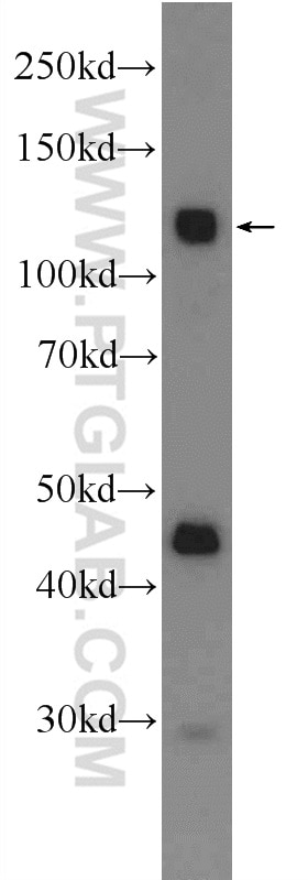 Western Blot (WB) analysis of A549 cells using CDCP1 Polyclonal antibody (12754-1-AP)