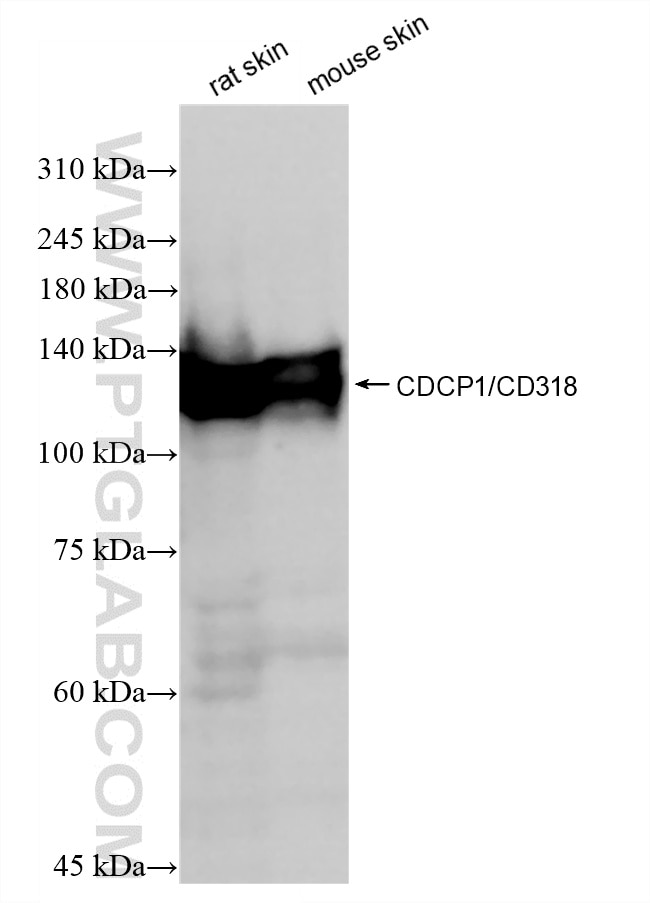 WB analysis using 87514-4-RR Western Blot (WB) analysis of various lysates using CDCP1/CD318 Recombinant monoclonal antibody (87514-4-RR)