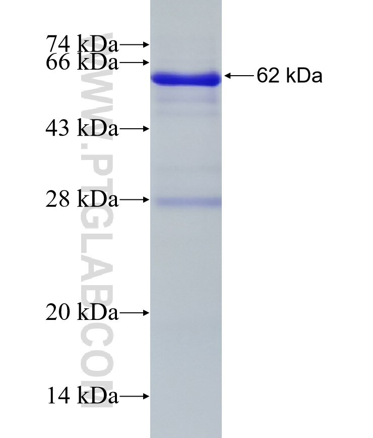 CDCP1 fusion protein Ag3439 SDS-PAGE