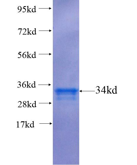 CDGAP fusion protein Ag25739 SDS-PAGE