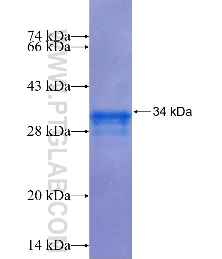 CDGAP fusion protein Ag25739 SDS-PAGE