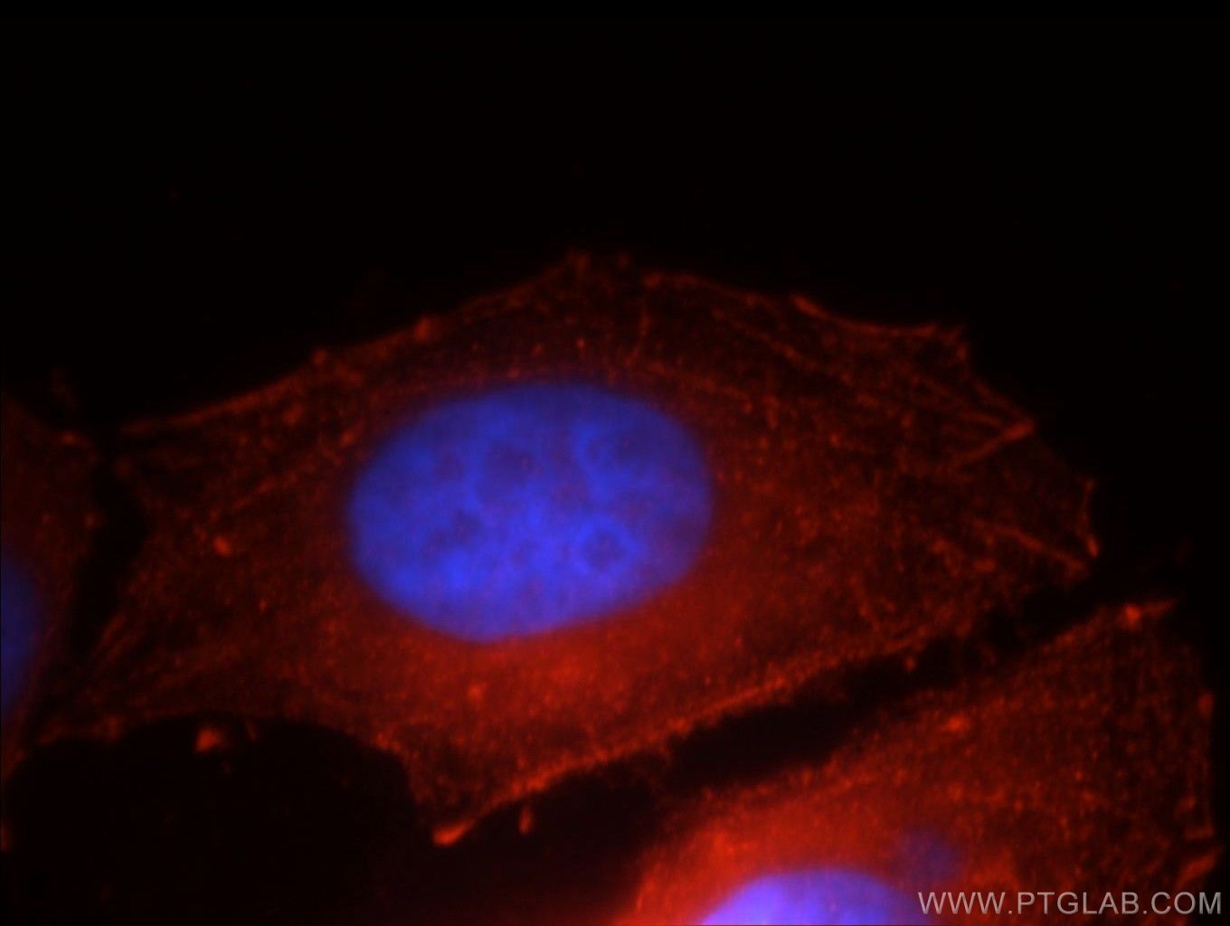 Immunofluorescence (IF) / fluorescent staining of HepG2 cells using E-cadherin Polyclonal antibody (20648-1-AP)