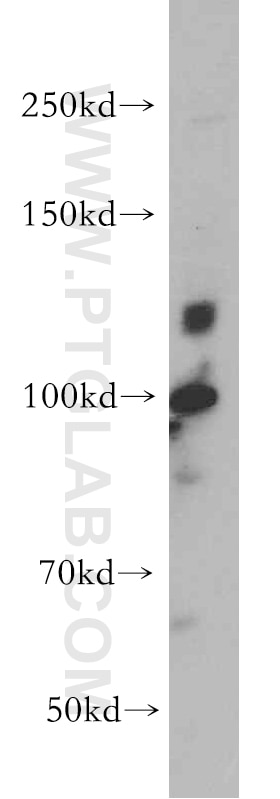 Western Blot (WB) analysis of PC-3 cells using E-cadherin Polyclonal antibody (20648-1-AP)