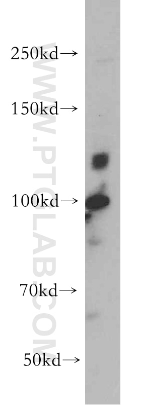 WB analysis of PC-3 using 20648-1-AP