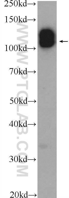 Western Blot (WB) analysis of mouse lung tissue using CDH10-specific Polyclonal antibody (19794-1-AP)