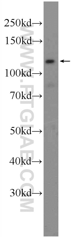 Western Blot (WB) analysis of rat lung tissue using CDH10-specific Polyclonal antibody (19794-1-AP)