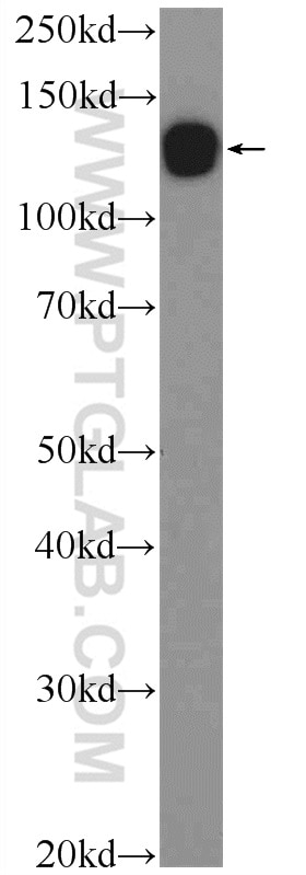 Western Blot (WB) analysis of rat brain tissue using CDH10-specific Polyclonal antibody (19794-1-AP)