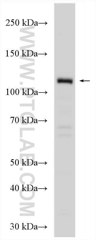 Western Blot (WB) analysis of PC-3 cells using Cadherin-11 Polyclonal antibody (12028-1-AP)