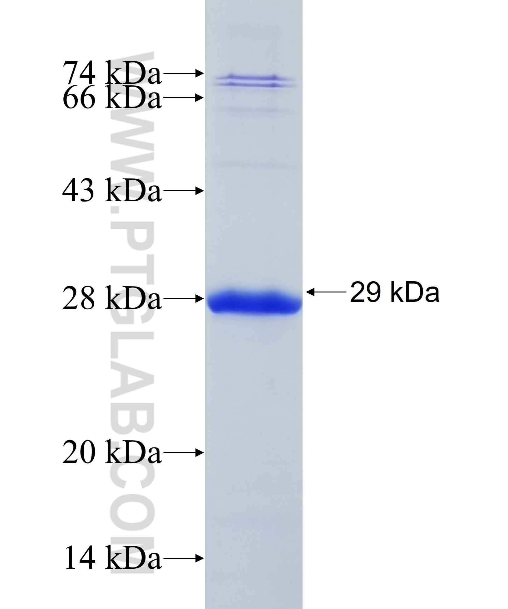 CDH12 fusion protein Ag32933 SDS-PAGE CDH12 fusion protein Ag32933 SDS-PAGE