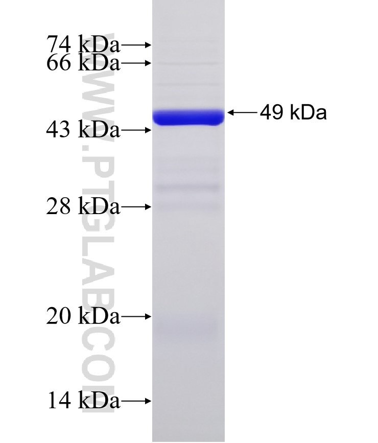 CDH12 fusion protein Ag32954 SDS-PAGE CDH12 fusion protein Ag32954 SDS-PAGE