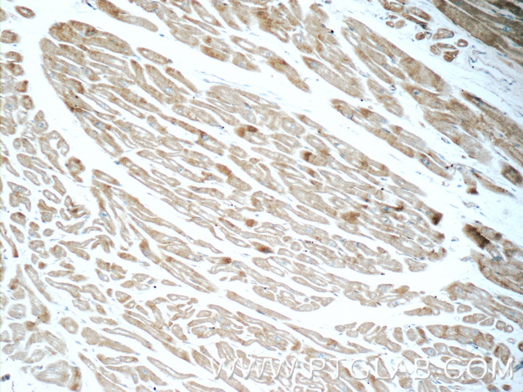Immunohistochemistry (IHC) staining of human heart tissue using Cadherin-13 Polyclonal antibody (12618-1-AP)